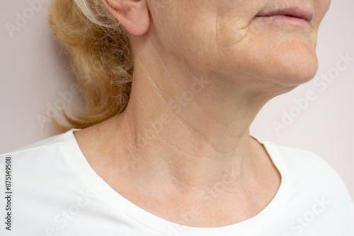 Close-up of creases and wrinkles on the neck of a elderly woman. Age-related skin changes, lines or rings of Venus. Flabby sagging skin. Beauty and women's health care concept