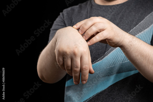 Ganglion cyst or hygroma of the wrist on the hand of a male patient