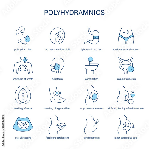 Polyhydramnios symptoms, diagnostic and treatment vector icons. Medical icons.