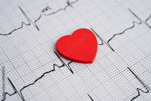 Electrocardiogram (ECG), heart wave, heart attack, cardiogram report.