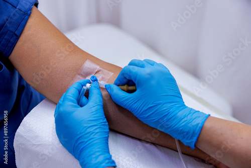 A patient with serum administered in the hospital. Serum is given to the patient. The serum that the nurse makes to her patient. While the doctor opens a vascular access to the patient.