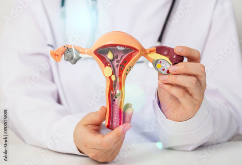 Doctor gynecologist holds a medical model of the female reproductive system in his hands. Concept of female infertility, cancer, ovarian cyst. Infections, close-up