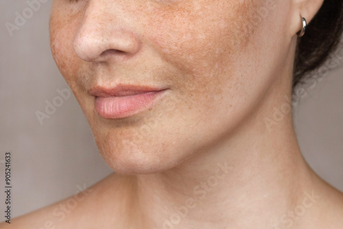 Close up caucasian woman's face with freckles or age spots photo. Age spots on the face