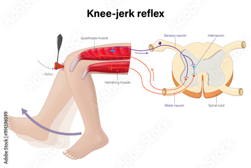 The knee-jerk reflex vector. Reflex action of the leg involves an involuntary response. Sensory neuron, motor neuron and interneuron.