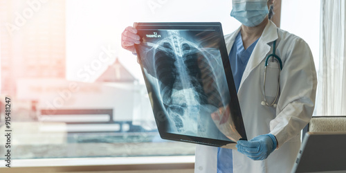 Doctor diagnosing patient’s health on asthma, lung disease, COVID-19 or bone cancer illness with radiological chest x-ray film for medical healthcare hospital service