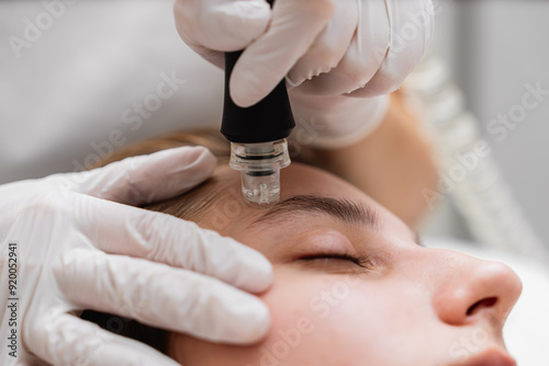 Microdermabrasion treatment session at a skincare clinic for facial rejuvenation