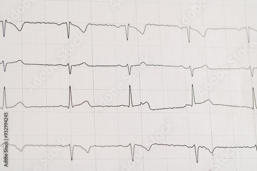 Izolowane badanie EKG serca na papierze z bliska