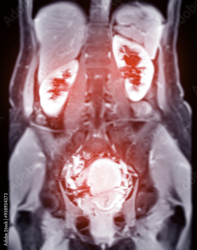 MRI abdomen coronal views are particularly useful for assessing liver, kidneys, and other abdominal organs with precision.