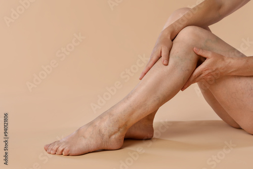 Woman suffering from varicose veins on beige background, closeup. Space for text