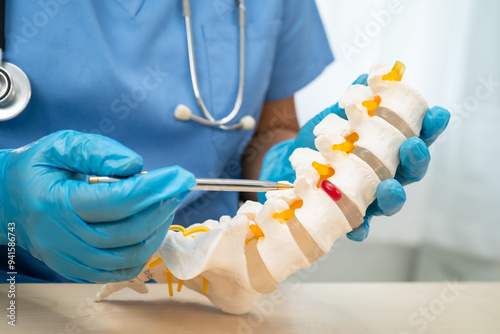 Doctor holding lumbar vertebrae spine skeleton bone and spinal nerve with displaced herniated disc fragment for treatment medical in the orthopedic department.