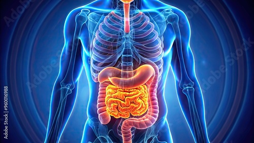 images of crohn's disease