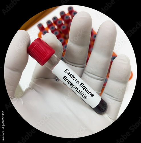 Blood test sample for Eastern equine encephalitis (EEE) virus test, also known as Triple E or sleeping sickness.