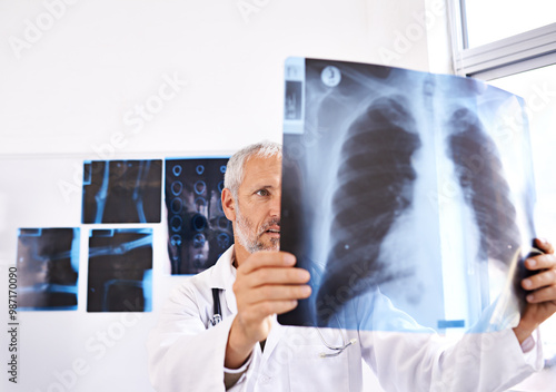 Xray, radiology and healthcare with doctor in hospital for medicine, results and tumor detection. Medical, insurance and lung cancer with mature man and scan for pneumonia or disease screening