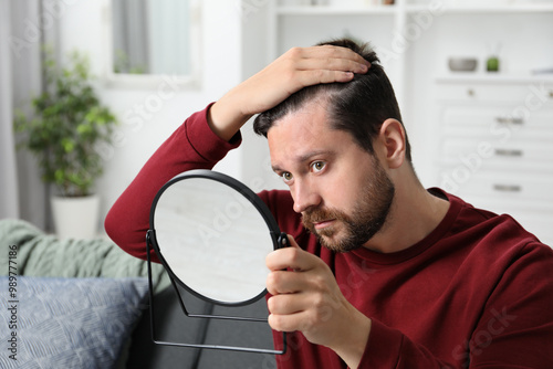 Man with hair loss problem looking at mirror indoors