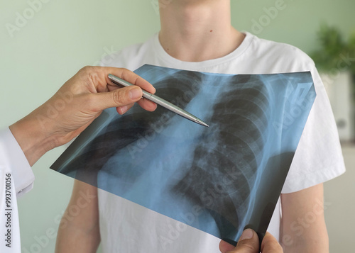 x ray thorax,doctor looks at the picture in the hospital for pneumonia and cancer concept