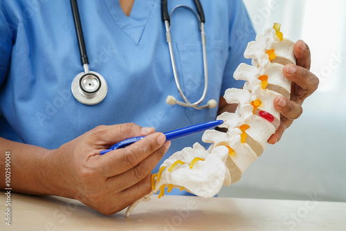 Asian doctor holding spinal nerve and bone model, Lumbar spine displaced herniated disc fragment for treatment medical in the orthopedic department.