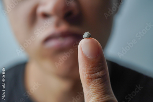 Close up photo of An Asian man is picking his nose with his pinky finger to find a booger. Cleaning the nose with a finger.