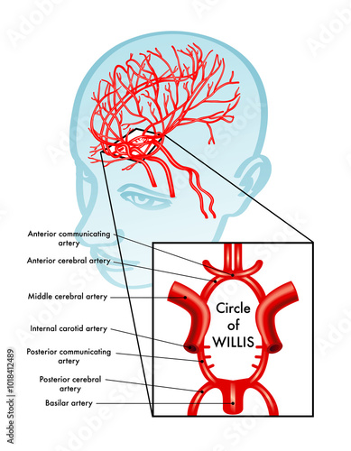 Medical illustration showing the location of the Circle of Willis in the brain.