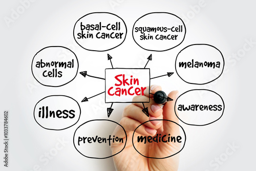 Skin cancer mind map, medical concept for presentations and reports