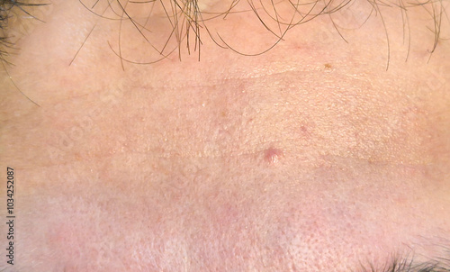 Close-up view of human skin showing texture, pores, and minor blemishes, highlighting the natural imperfections of skin.