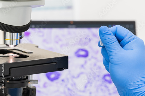 Scientist wear blue glove holding parafin human tissue block and out of focus microscope and computer monitor show glandular image.Medical patholology and cytology laboratory technology concept.