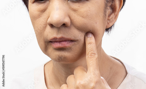 Flabby and wrinkled skin on senior woman face.