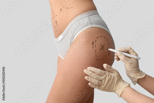 Plastic surgeon marking woman's butt on light background, closeup