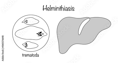 Helminths that infect the liver