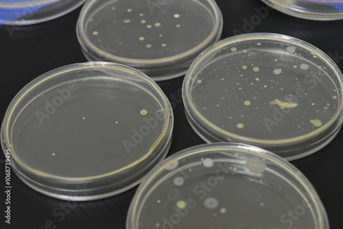 Colonies of bacteria growth on agar plate medium in laboratory.