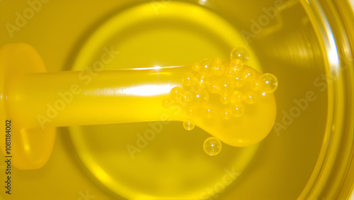 Golden yellow urine specimen in a transparent container filled with an excessive amount of clear bubbles, indicating potential kidney or urinary tract issues.