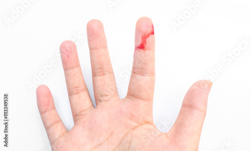 Wound on finger with blood from knife cut. Close up of human finger injured and bleeding with bright red blood isolated on white background